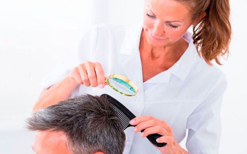 treatment of psoriasis of the scalp