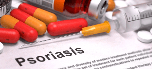 psoriasis medications