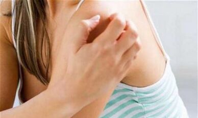 a girl scratching her shoulder